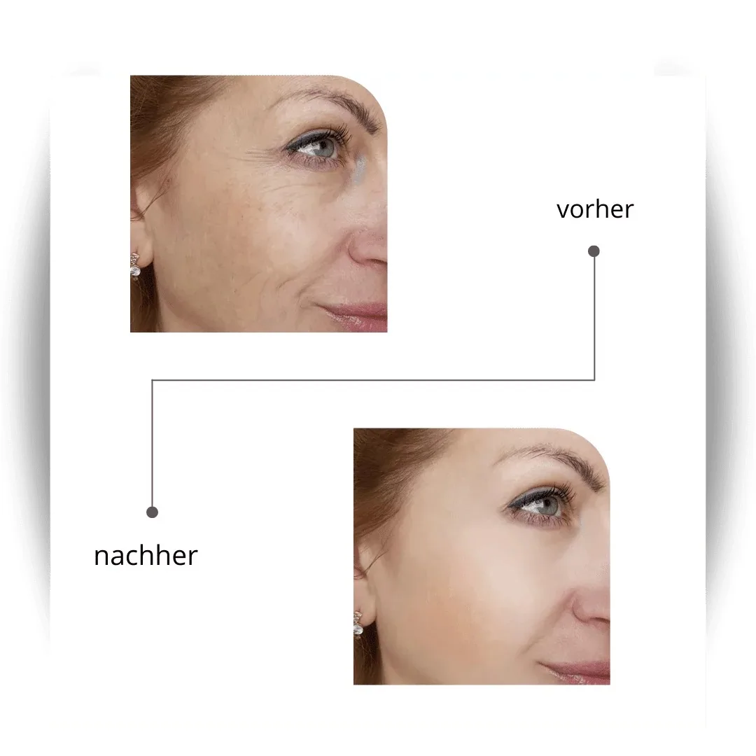 Ergebnis Anti-Aging Behandlung – Kosmetikstudio Beate Hornaff Ludwigsburg